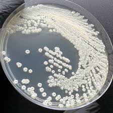 Image result for Gonatopus clavatus