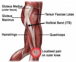 Check spelling or type a new query. The Secret To Resolving It Band Syndrome Using Thai Massage Thai Sport Bodyworks