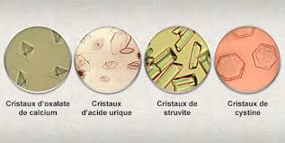 L'analyse des cristaux urinaires par examen microscopique est un. Les Analyses D Urine Clinique Veterinaire Adhocvet