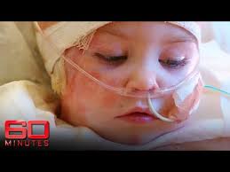 Child Battling One of the Rarest Fatal Diseases in the World