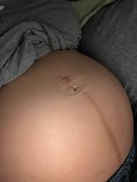 Linea nigra, what is linea, the common causes, the risk factors, when does the black line go away. What Is Up With My Belly Line Linea Nigra 1st Pregnancy Forums What To Expect