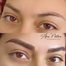 Ananateramicropigmentacion