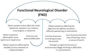 Image result for Functional Aphonia