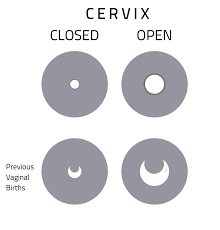 Image result for cervix position