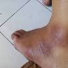 Daki terbentuk dari kotoran udara atau debu yang menempel sehingga menyatu dengan keringat. 1