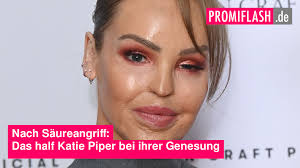 Nach Säureangriff: Das half Katie Piper bei ihrer Genesung