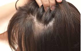 That's why if you have thin hair, it's a good idea to use darker colors and if you have thick hair, you should go for lighter ones. Do You Have Thin And Bald Hair Try This Simple Method To Get Thicker Hair Naturally