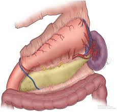 That's probably the most concerning symptom. Current Treatment And Recent Progress In Gastric Cancer Joshi 2021 Ca A Cancer Journal For Clinicians Wiley Online Library