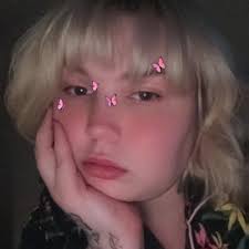 Car meet accident: man injured between two cars