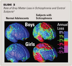 Social cognition and schizophrenia / edited by corrigan p. Schizophrenia Summing It Up Emotion Brain Behavior Laboratory