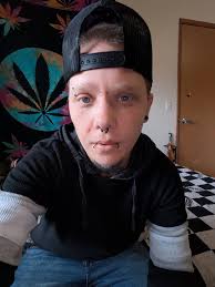 Had my pre-registration today.... one week and counting. Do I have any  surgery twin in the 18th. Let's chat