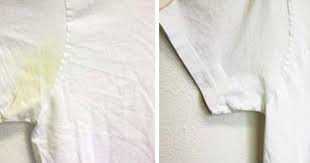 Does white vinegar remove sweat stains? How To Remove Sweat Stains From White Clothes