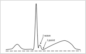 Image result for J Point