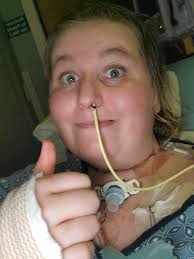 Two years ago I was diagnosed with squamous cell carcinoma of the tongue.  Cancer. I had a bilateral neck disection where they biopsied lymph nodes  from both sides of my neck. Then,