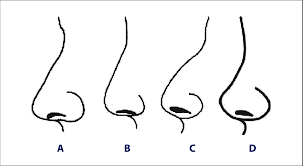 We will reveal the secret of how to determine a person's character by the types of nose. Different Types Of Noses A Straight Nose Long Nasal Dorsum A A Download Scientific Diagram