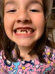 It's National Tooth Fairy Day! We want to see your tooth fairy pics! Email  us at goodday@kmaxtv.com or upload in the comments!