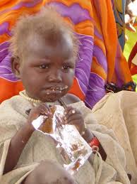 Community-based therapeutic care: treating severe acute malnutrition in  sub-Saharan Africa