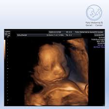 3d 4d baby ultrasound and photography also offers early gender dna detection tests offered to women starting at 9 weeks into pregnancy. 25th Week Of Gestation Ultrasound Scan 25 Weeks Pregnant Ultrasound Pregnant