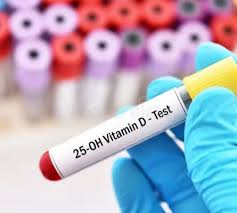 Vitamin D (25 OH) Blood Test - ARC Medical