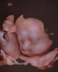 June dump ✨🤰🌊🌴👶🏼