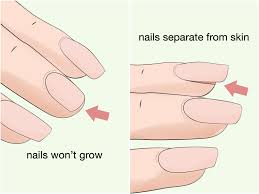 This thins your natural nails, making them weaker. 4 Ways To Strengthen Weak Fingernails Naturally Wikihow