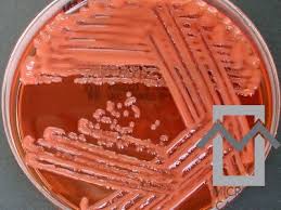 Image result for Rhizobium radiobacter, syn. Agrobacterium tumefaciens