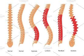 From this angle, the spine almost resembles a soft 's' shape. Osteoporosis Bone Types Infographics Osteoporosis Bones Infographic Osteoporosis