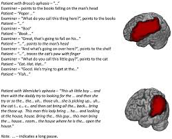 Image result for Aphasia