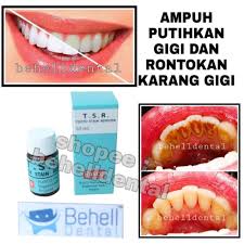 Cara mengobati sakit gigi dengan bawang putih, yakni sebagai berikut obat jenis ini bekerja dengan mengurangi peradangan dengan menghalangi tubuh memproduksi prostaglandin. Tsr Ori Pemutih Gigi Ampuh Penghilang Bau Mulut Pelunak Karang Gigi Bleaching Whitening Teeth Shopee Indonesia
