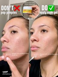 Essential Skincare Do's and Don'ts for Healthy Skin