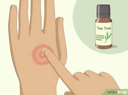 Have you tried to buy hand sanitizer lately? How To Get Rid Of Ringworm Can Natural Remedies Help