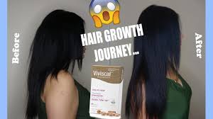 Nioxin system 2 cleanser & scalp therapy conditioner liter duo 2 Month Viviscal Hair Growth Before After Youtube