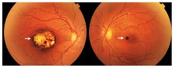 Image result for Chorisochora transvaalensis