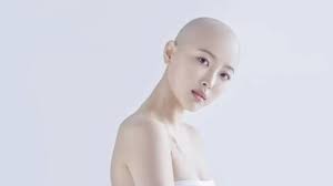 Dampak jika tubuh kekurangan zat besi, seperti nia ramadhani. Kisah Dawn Lee Vlogger Kecantikan Korea Yang Terkena Kanker Getah Bening Lifestyle Liputan6 Com