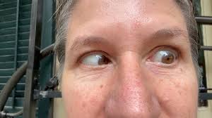 Can anyone else move their eyes semi-independently? I can also hide  gum/food behind my tongue (in my throat? 🤷‍♀️ ) and talk with it back  there, then bring it back into my mouth at-will. It was great ...