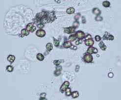 Pin On Clinical Laboratories Science