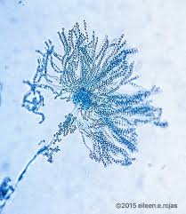 Of all the aspergillus species, aspergillus fumigatus is the most tolerant to temperature and can grow in environments between 20 degrees celsius and 55 degrees celsius. Aspergillus Fumigatus Complex Chaetomium Queen Chaetomium Queen