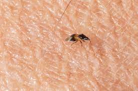 You might have tried some expensive products to get rid of these invisible mites. Little Black Bug Big Bite Purdue University Pest Crop Newsletter