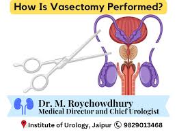 Image result for Vasectomy