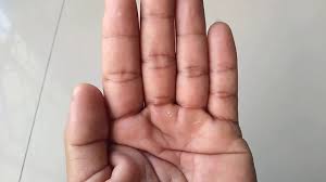 Namun, kondisi ini juga bisa menjadi gejala gangguan kesehatan yang. Ramalan Telapak Tangan Kiri Gatal Menurut Primbon Jawa Youtube