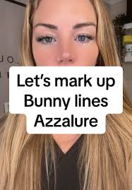Smooth Bunny Lines with Botox or Azzalure Treatments