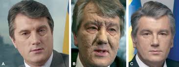 Skin diseases associated with Agent Orange and other organochlorine  exposures