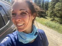 Fort Collins Woman Survives 60-Foot Fall While Climbing 14er Near  Telluride, Then Climbs Seven Miles To Safety