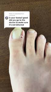 Image result for Onychotillomania feet