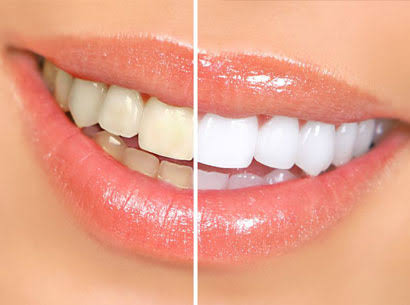 Cosmetic Dentist | Jussmile Dental Clinic Chennai