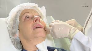 Amalian dermal fillers are manufactured in germany and underlie strict quality control. Part 1 Amalian Dermal Filler Injection Techniques Youtube