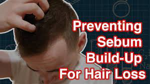 If balding is from sebum buildup and calcification, how do you explain hair thinning in the temple and front hairline where the skin is more loose and pliable? Sebum Buildup 3 Causes 2 Steps To Get Rid Of It Hairguard