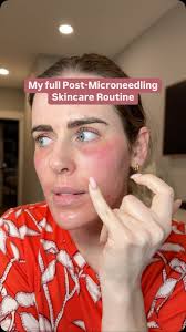 We did the hydrating HA mask… now