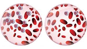 The Difference Between Acute And Chronic Leukemia