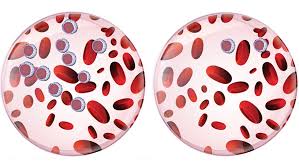 The Difference Between Acute And Chronic Leukemia